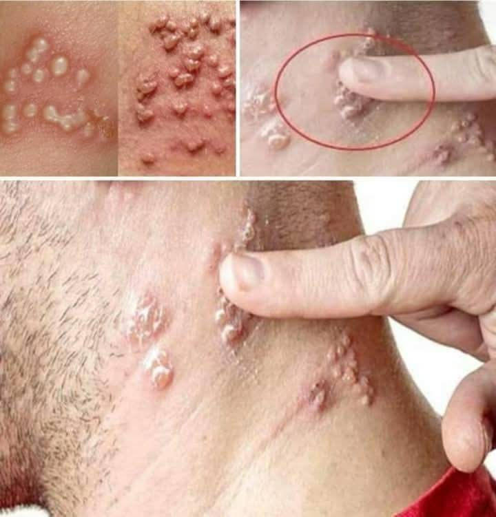 ⚠️ BE CAREFUL, If you spot these dots on your skin, it means you have Ca…see more