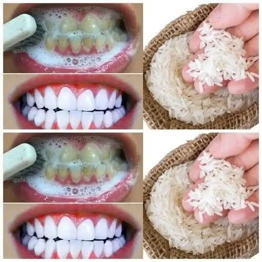 Teeth Whitening Hack in Just 1 Minute That No Dentist Wants You to Know!